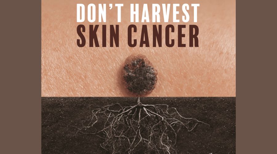 Melanoma Focus charity carried out a study which revealed that over half of British farmers rarely or never wear sunscreen in the summer.
